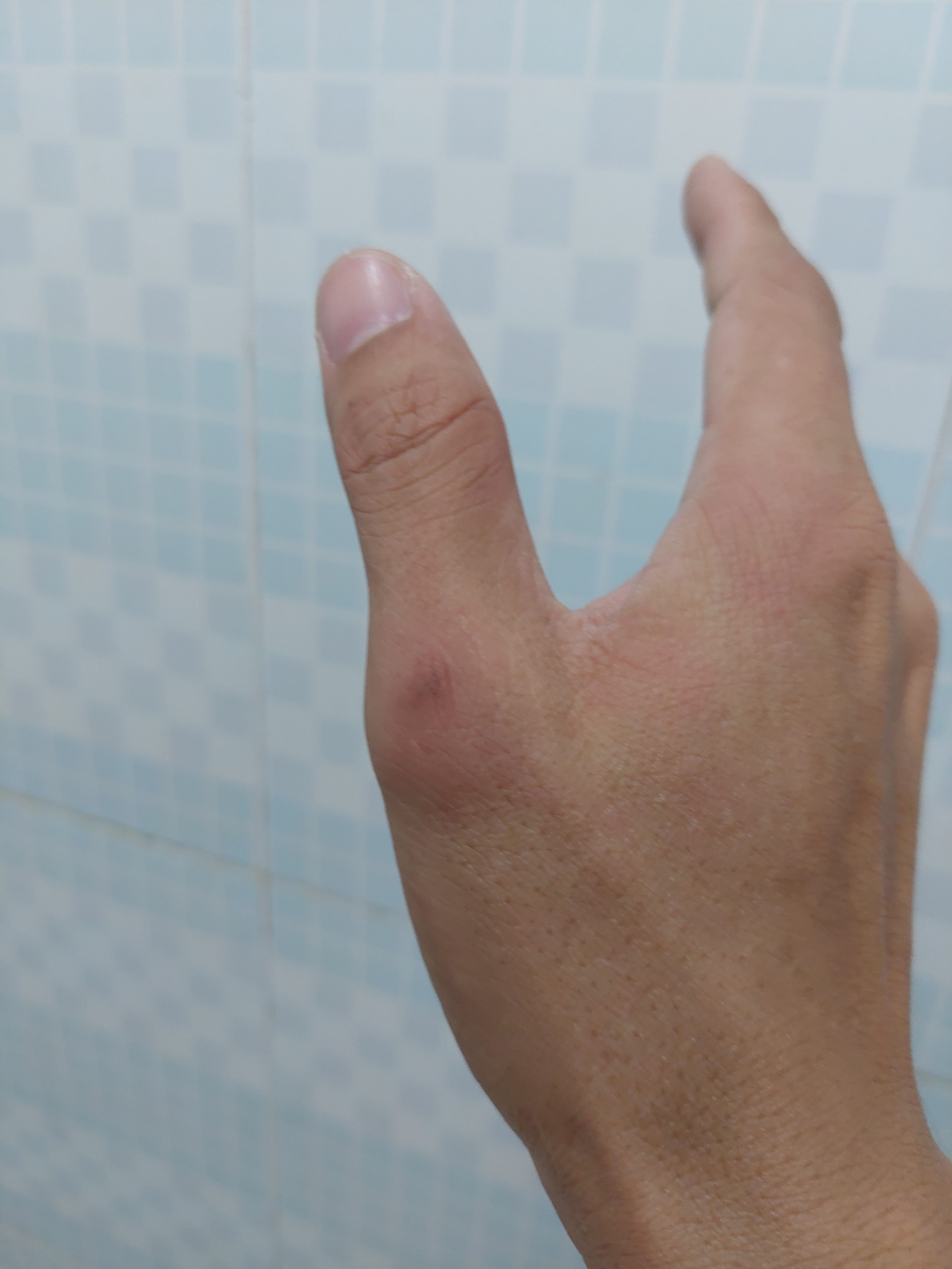 inbound7621764299075088904